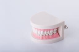 東京で人気の美容・審美治療メニュー⑦義歯（入れ歯）治療